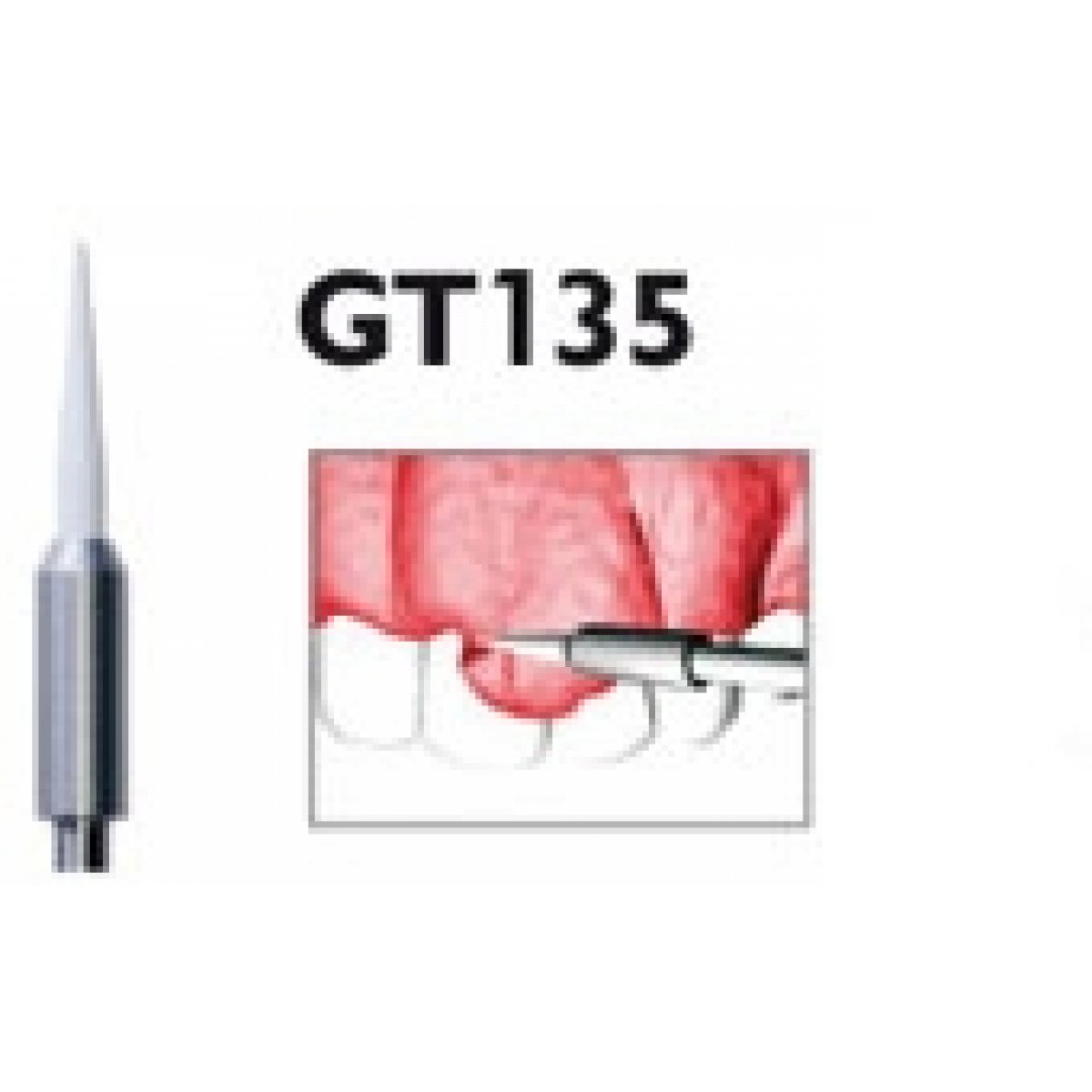 H+M Gingivatrimmer Fig. GT135 | Gingivatrimmer GT135/016, Packung 1 Stück